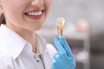 Bone Grafting for Dental Implants compatible